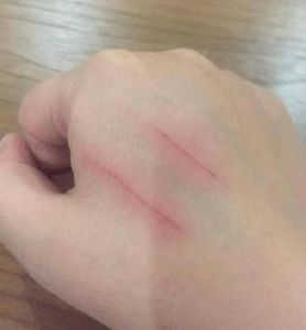 家养刚出生没多久小猫抓伤_小猫抓伤别慌，正确处理防感染，注意狂犬病！