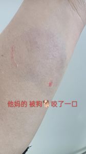 被自己从小养大的狗咬了_被狗咬伤别慌，肥皂水冲净，消毒贴上，观察变化及时就医！