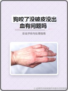 不知道狗咬没咬到咋判断_被狗咬了？别慌，看牙印冲肥皂水涂碘伏，打疫苗别忘了！