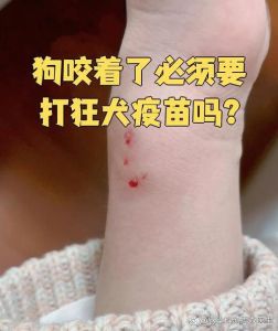 狗咬了很浅要警惕图片_被狗咬伤别大意！小伤口也需科学处理和打疫苗